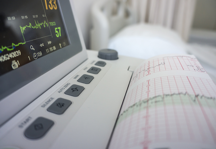 Fetal Monitor Details in Hospital Room